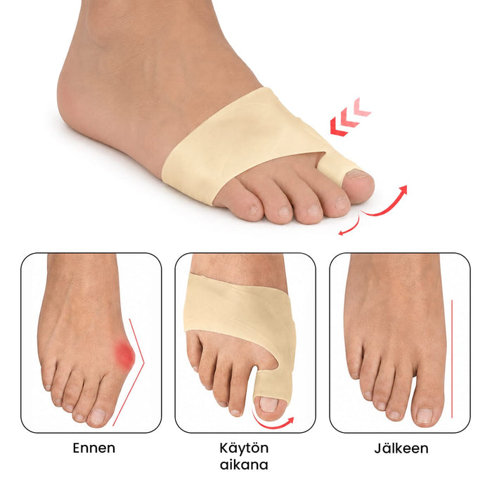 Geelisukka hallux valgukseen