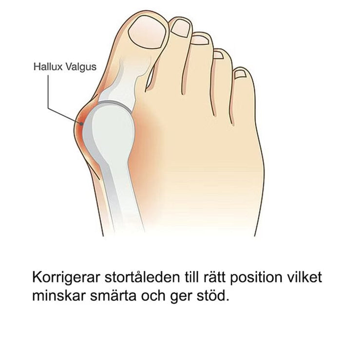 Vartalokauppa Hallux Valgus Oletusotsikko Hallux valgus -silicone suoja