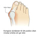 Vartalokauppa Hallux Valgus Oletusotsikko Hallux valgus -silicone suoja